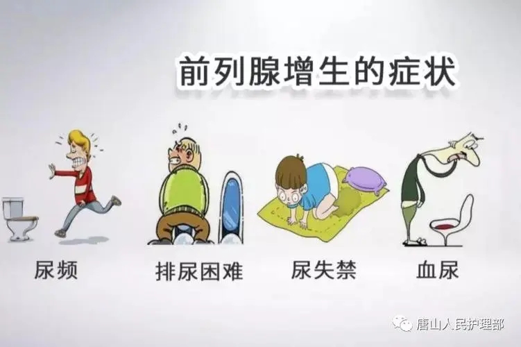 前列腺增生的危害 前列腺增生的早期症状表现